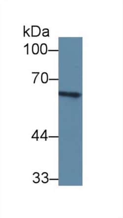 C8A Polyclonal Antibody, Invitrogen:Antibodies:Primary Antibodies