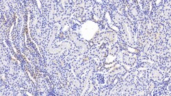 Invitrogen PEX1 Polyclonal Antibody, Invitrogen 20 &mu;L; Unconjugated:Antibodies,