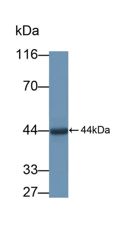Invitrogen PEX1 Polyclonal Antibody, Invitrogen 20 &mu;L; Unconjugated:Antibodies,