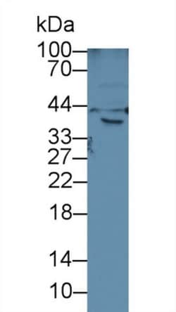 Invitrogen HFE2 Polyclonal Antibody, Invitrogen 20 &mu;L; Unconjugated:Antibodies,