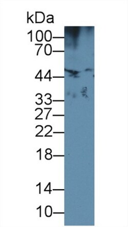 Invitrogen HFE2 Polyclonal Antibody, Invitrogen 20 &mu;L; Unconjugated:Antibodies,