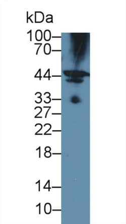 Invitrogen HFE2 Polyclonal Antibody, Invitrogen 20 &mu;L; Unconjugated:Antibodies,