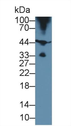 Invitrogen HFE2 Polyclonal Antibody, Invitrogen 20 &mu;L; Unconjugated:Antibodies,