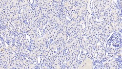 ACSM1 Polyclonal Antibody, Invitrogen:Antibodies:Primary Antibodies
