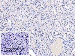 Invitrogen ACSM1 Polyclonal Antibody, Invitrogen 200 &mu;L; Unconjugated:Antibodies,