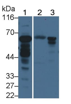 ACSM1 Polyclonal Antibody, Invitrogen:Antibodies:Primary Antibodies