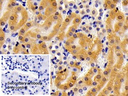 Invitrogen CPPED1 Polyclonal Antibody, Invitrogen 20 &mu;L; Unconjugated:Antibodies,
