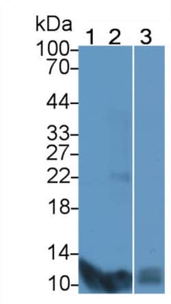 Invitrogen S100A7 Polyclonal Antibody, Invitrogen 20 &mu;L; Unconjugated:Antibodies,