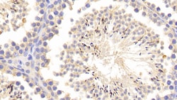 MMP1 Polyclonal Antibody, Invitrogen:Antibodies:Primary Antibodies