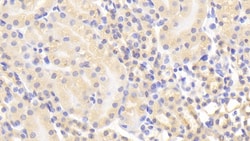 MMP1 Polyclonal Antibody, Invitrogen:Antibodies:Primary Antibodies