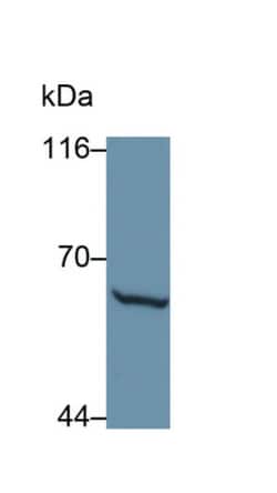 MMP1 Polyclonal Antibody, Invitrogen:Antibodies:Primary Antibodies