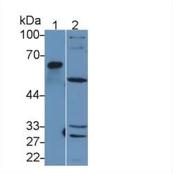 MMP1 Polyclonal Antibody, Invitrogen:Antibodies:Primary Antibodies