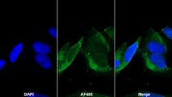 Invitrogen SEMA5B Polyclonal Antibody, Invitrogen 200 μL; Unconjugated:Antibodies,