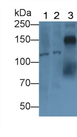 SEMA5B Polyclonal Antibody, Invitrogen:Antibodies:Primary Antibodies