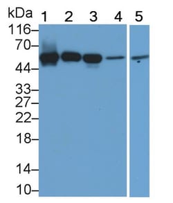 Invitrogen Acid Phosphatase 2 Polyclonal Antibody, Invitrogen 200 &mu;L;
