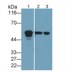 Invitrogen Acid Phosphatase 2 Polyclonal Antibody, Invitrogen 200 &mu;L;