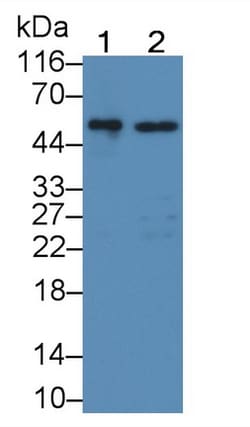 Invitrogen GBA Polyclonal Antibody, Invitrogen 200 &mu;L; Unconjugated:Antibodies,