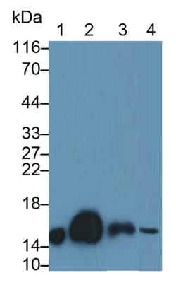 Invitrogen Cystatin C Polyclonal Antibody, Invitrogen:Antibodies:Primary