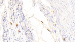 Tryptase Polyclonal Antibody, Invitrogen:Antibodies:Primary Antibodies