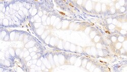 Tryptase Polyclonal Antibody, Invitrogen:Antibodies:Primary Antibodies
