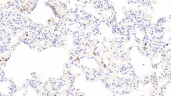 Tryptase Polyclonal Antibody, Invitrogen:Antibodies:Primary Antibodies