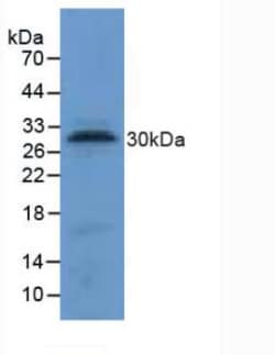 Tryptase Polyclonal Antibody, Invitrogen:Antibodies:Primary Antibodies