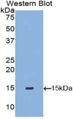 Tryptase Polyclonal Antibody, Invitrogen:Antibodies:Primary Antibodies