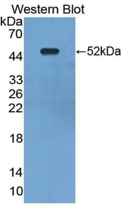 Invitrogen Synphilin 1 Polyclonal Antibody, Invitrogen 200 &mu;L; Unconjugated:Antibodies,
