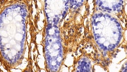 Invitrogen Fibrinogen Polyclonal Antibody, Invitrogen 200 &mu;L; Unconjugated:Antibodies,