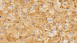 Invitrogen Fibrinogen Polyclonal Antibody, Invitrogen 200 &mu;L; Unconjugated:Antibodies,