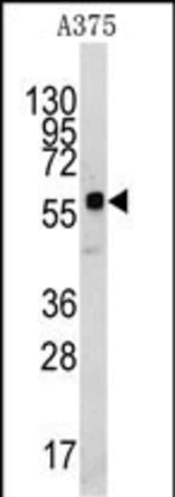 Invitrogen KREMEN1 Polyclonal Antibody 400 &mu;L; Unconjugated:Antibodies,
