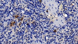 Invitrogen Neutrophil elastase Polyclonal Antibody, Invitrogen 200 &mu;L;
