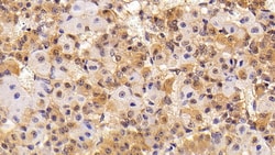 Invitrogen TSH beta Polyclonal Antibody, Invitrogen:Antibodies:Primary