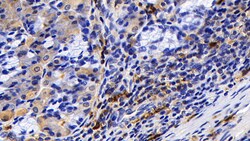 Invitrogen Tryptase Polyclonal Antibody, Invitrogen 200 &mu;L; Unconjugated:Antibodies,