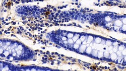 Invitrogen Tryptase Polyclonal Antibody, Invitrogen 200 &mu;L; Unconjugated:Antibodies,
