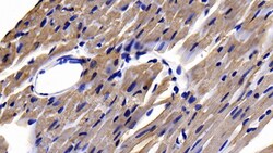 Invitrogen APAF1 Polyclonal Antibody, Invitrogen 20 &mu;L; Unconjugated:Antibodies,