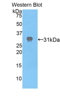 Invitrogen APAF1 Polyclonal Antibody, Invitrogen 20 &mu;L; Unconjugated:Antibodies,