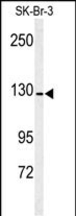 Invitrogen CD13 Polyclonal Antibody 400 &mu;L; Unconjugated:Antibodies,