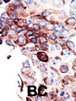 Invitrogen Axl Polyclonal Antibody 400 μL; Unconjugated:Antibodies,