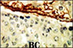 Invitrogen EphA4 Polyclonal Antibody 400 &mu;L; Unconjugated:Antibodies,