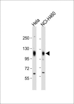 Invitrogen EphA4 Polyclonal Antibody 400 &mu;L; Unconjugated:Antibodies,