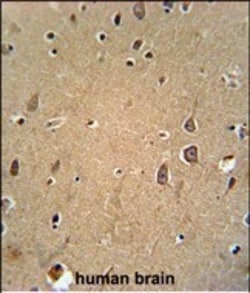 Invitrogen EphA6 Polyclonal Antibody 400 &mu;L; Unconjugated:Antibodies,