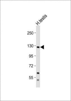Invitrogen EphA6 Polyclonal Antibody 400 &mu;L; Unconjugated:Antibodies,
