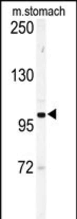 Invitrogen EphA6 Polyclonal Antibody 400 &mu;L; Unconjugated:Antibodies,