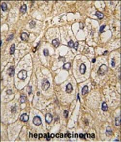 Invitrogen EphA7 Polyclonal Antibody 400 &mu;L | Buy Online | Invitrogen&trade; | Fisher Scientific