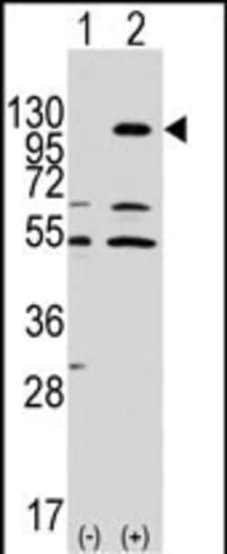Invitrogen EphA7 Polyclonal Antibody 400 &mu;L | Buy Online | Invitrogen&trade; | Fisher Scientific