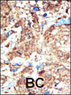 Invitrogen EphB1 Polyclonal Antibody 400 &mu;L; Unconjugated:Antibodies,