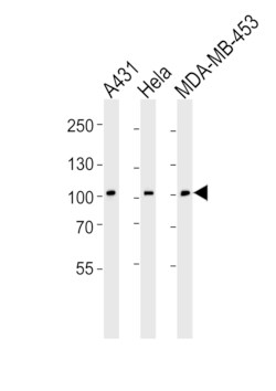 Invitrogen EphB1 Polyclonal Antibody 400 &mu;L; Unconjugated:Antibodies,