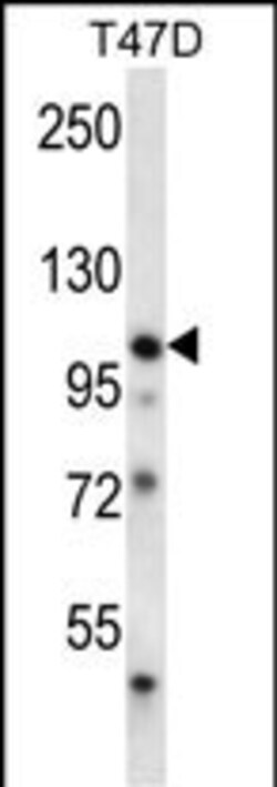 Invitrogen EphB1 Polyclonal Antibody 400 &mu;L; Unconjugated:Antibodies,