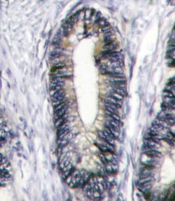 Invitrogen EphB2 Polyclonal Antibody 400 &mu;L; Unconjugated:Antibodies,